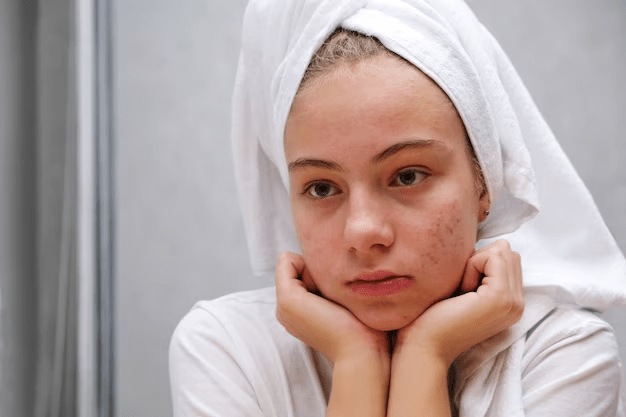 Como Escolher o Melhor Protetor Solar para Pele&nbsp;Oleosa